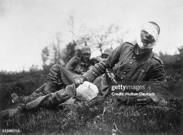 Wounded German soldier with a bandage around his head, he holds a spiked helmet, 18th May 1915.