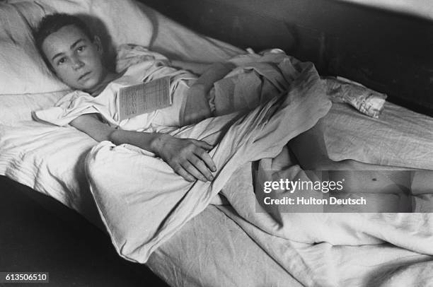 Jewish victim of Belsen recuperates in bed after the Allies liberation of the Nazi concentration camp, summer 1945.