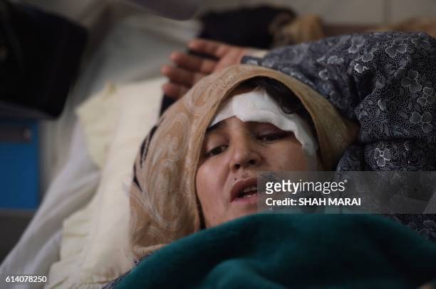 An Afghan wounded woman receives treatment at the Ali Abad hospital after an attack by gunmen inside the Karte Sakhi shrine in Kabul on October 12,...