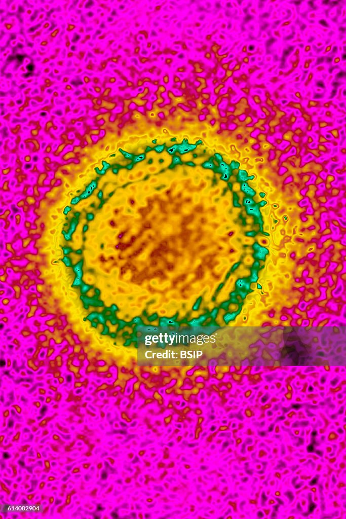 Dengue virus