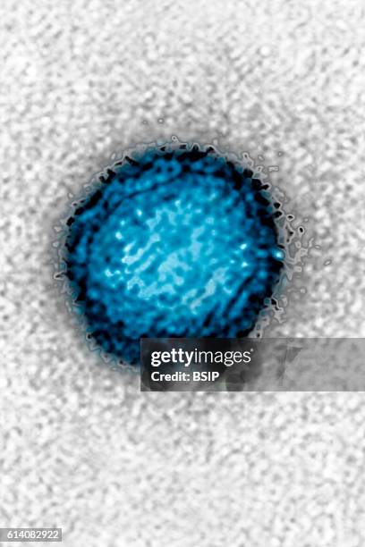 Dengue and Zika . It is an arbovirus, a member of the Flavivirus family. Seen by transmission electron microscopy . Viral diameter, 75-100 nm.