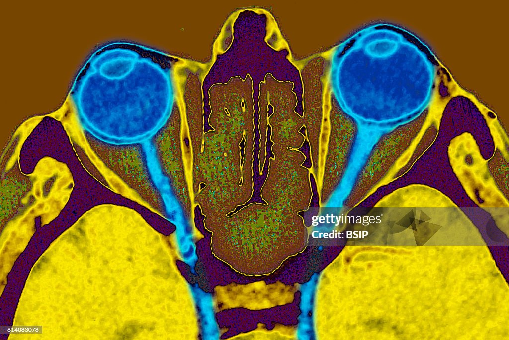 Optic nerve, scan