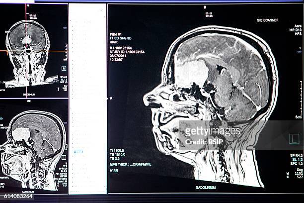 Radiology service in a hospital in Haute-Savoie, France. MRI scan.