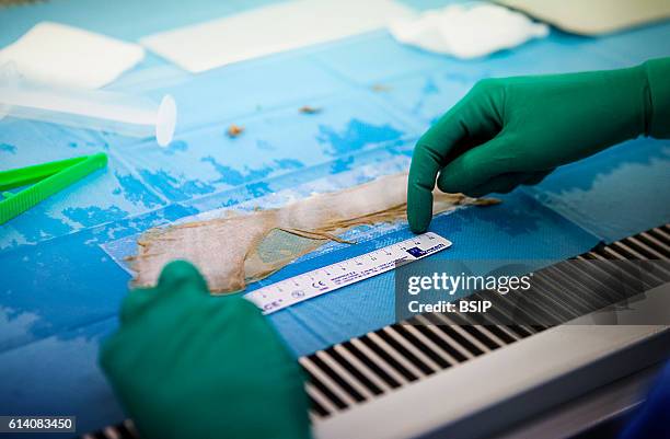 Tissue and cell bank belonging to the EFS . The bank's mission is to ensure France's self-sufficiency in cell and tissue products. The bank prepares,...