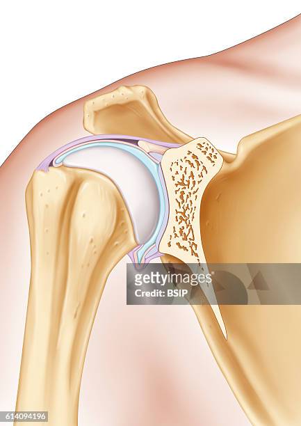 Illustration of the shoulder joint. The two joint surfaces are visible, the joint socket of the shoulder blade and the proximal humerus epiphysis ....