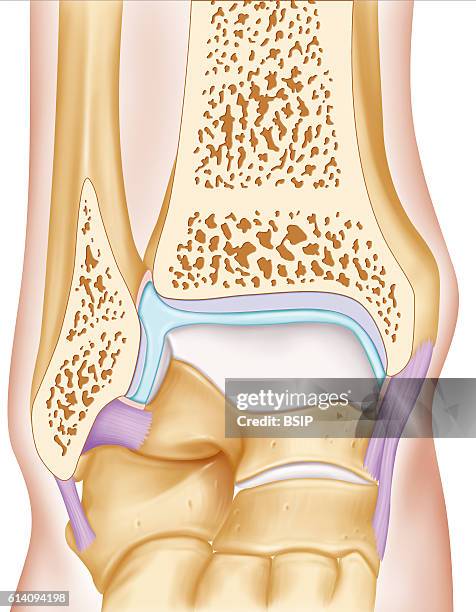 Distal Tibia Rotation Distal Tibia Photos and Premium High Res Pictures - Getty Images