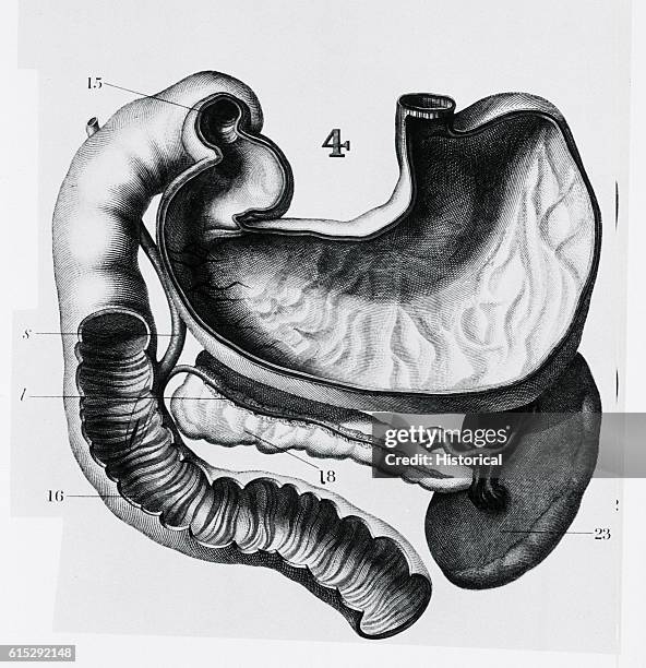 An anatomic diagram depicts part of a human digestive tract, the stomach, spleen, pancreas, and large intestine.