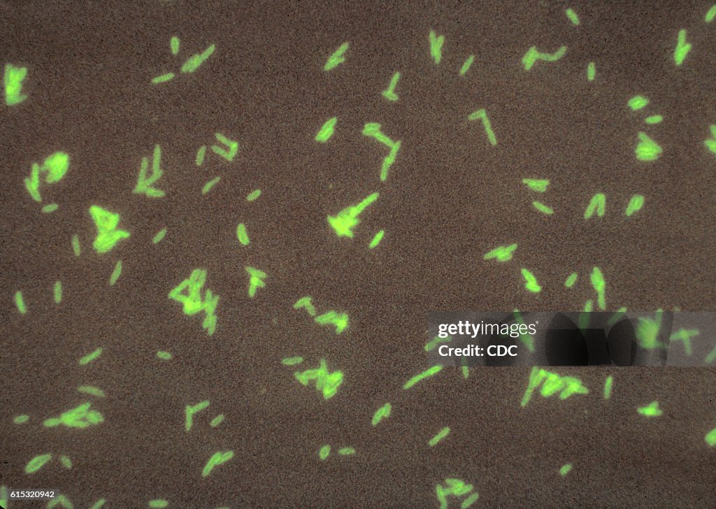 Legionella Pneumophila