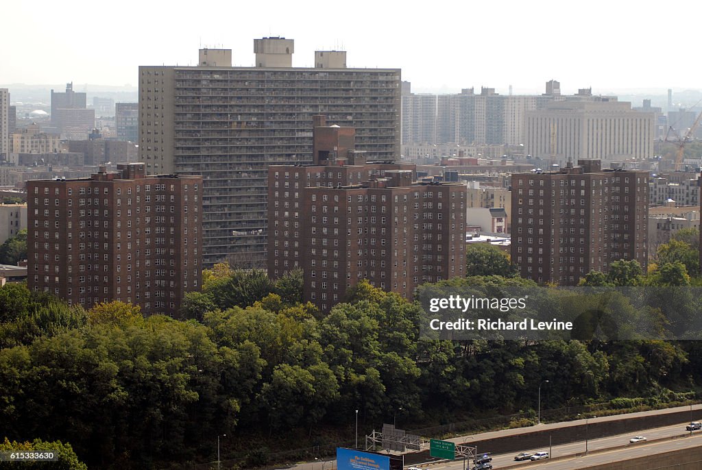 Bronx the least healthy county in New York State