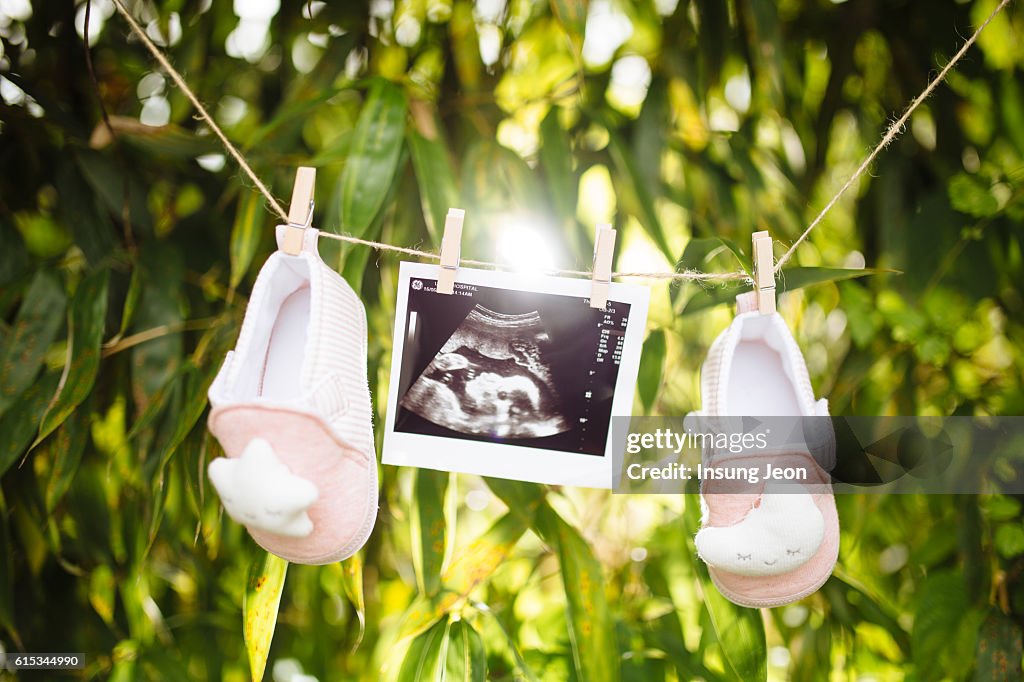 Baby's shoes and ultrasound image on laundry clothesline