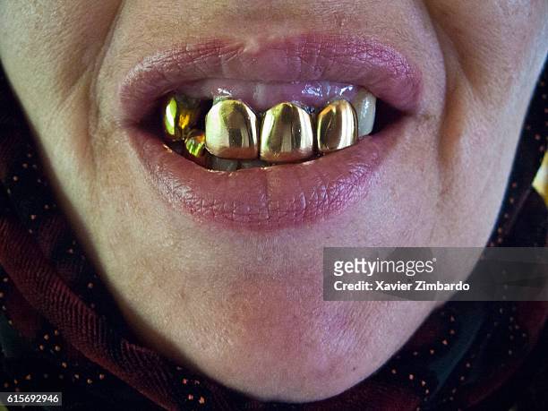 Close-up of woman mouth with gold teeth on June 10, 2008 in Moscow, Russia