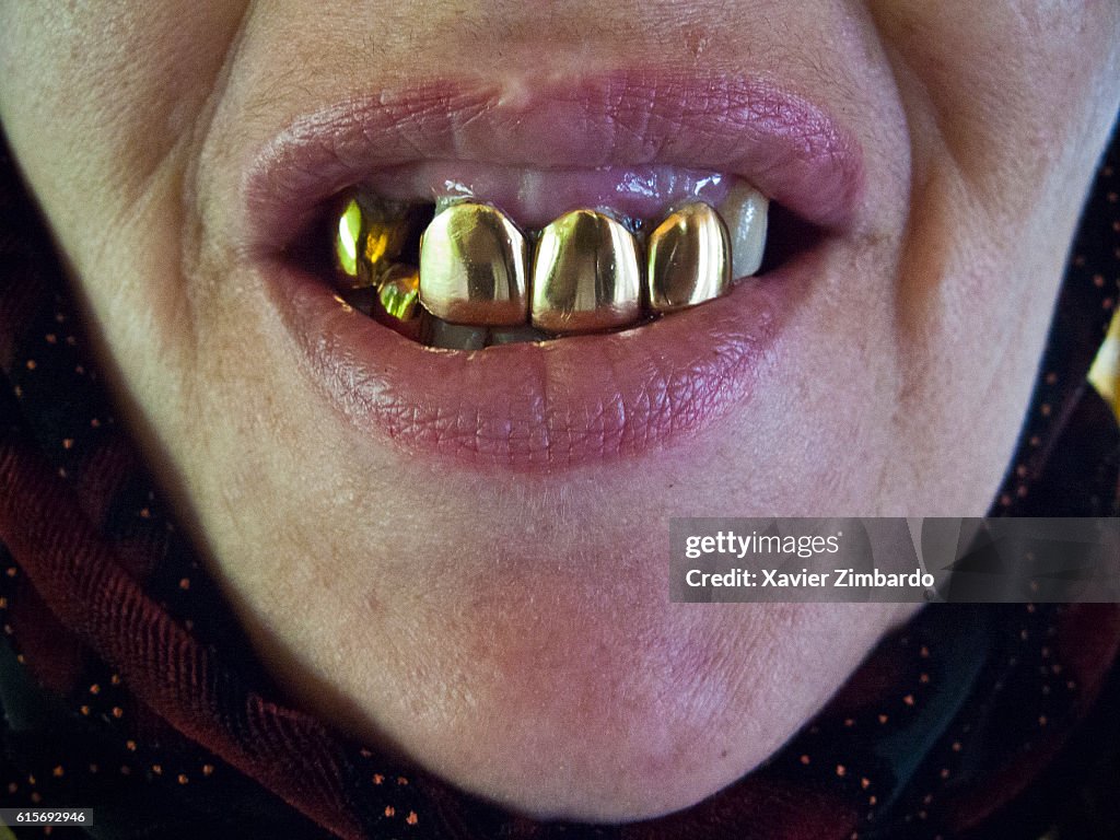 Female Tooth Rouge Close-up of woman mouth with gold teeth on June 10, 2008 in Moscow ...