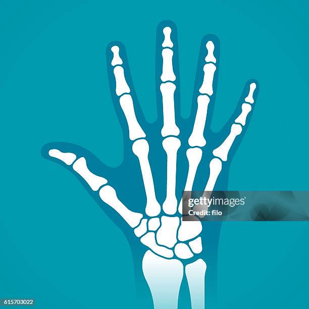 illustrazioni stock, clip art, cartoni animati e icone di tendenza di una radiografia della mano - rotto