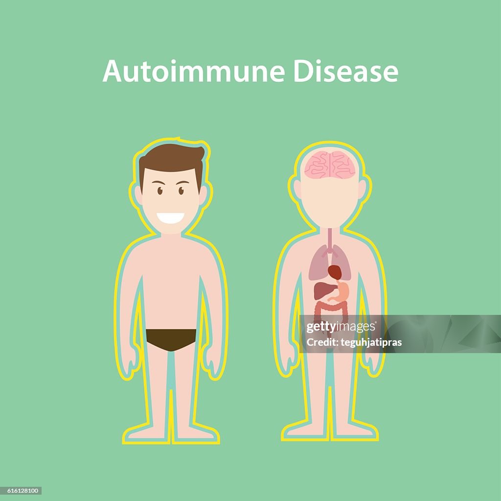 Autoimmunity Animation Autoimmune Disease System Illustration With Cartoon Human Man Body ...