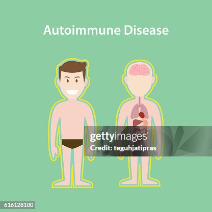 Autoimmunity Animation Autoimmune Disease System Illustration With Cartoon Human Man Body ...