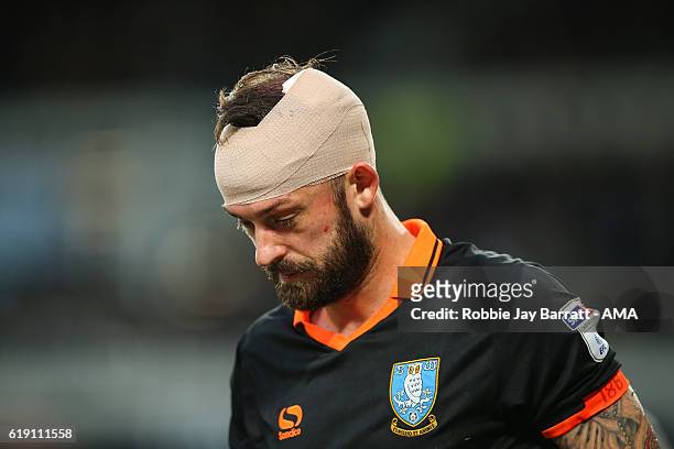 Steven Fletcher of Sheffield Wednesday with a head bandage after a head injury during the Sky Bet Championship match between Derby County and...