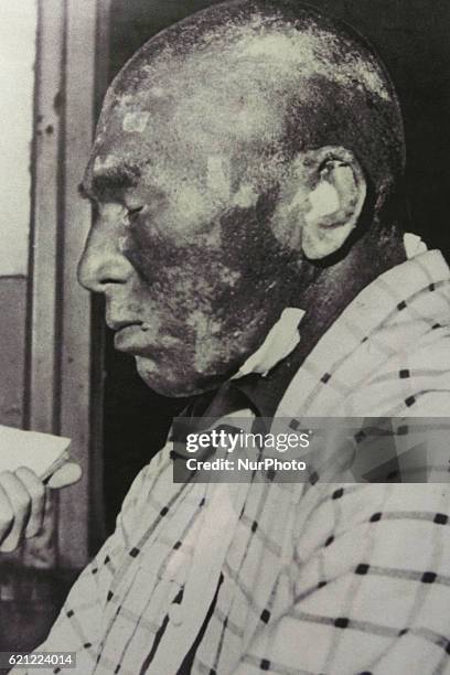 Portrait of one of the crew focusing on the burn and general skin discoloration of the fishing boat DaiGo Fukuryu Maru on display in Tokyo on 5...