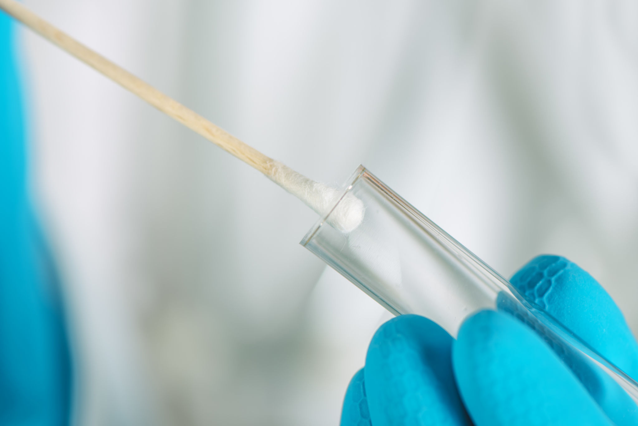 DNA sample collection