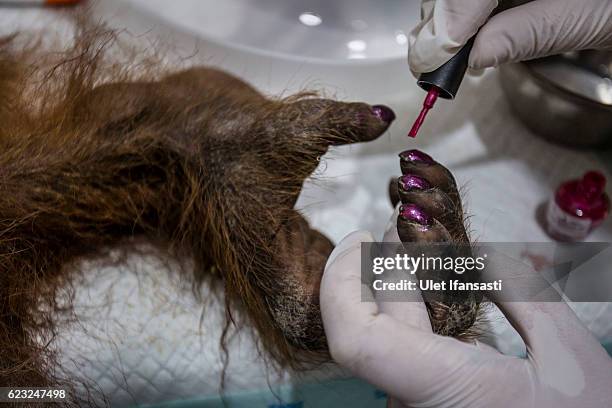 Staff of Sumatran Orangutan Conservation Programme puts nail polish on an sumatran orangutan to distract him after the surgery at Sumatran Orangutan...