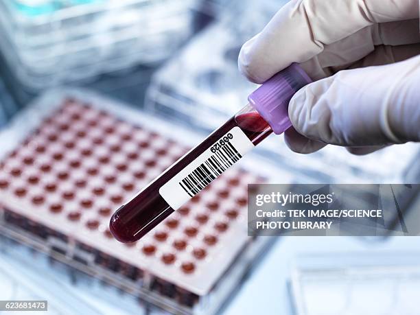 blood testing - blood collection tube stock-grafiken, -clipart, -cartoons und -symbole