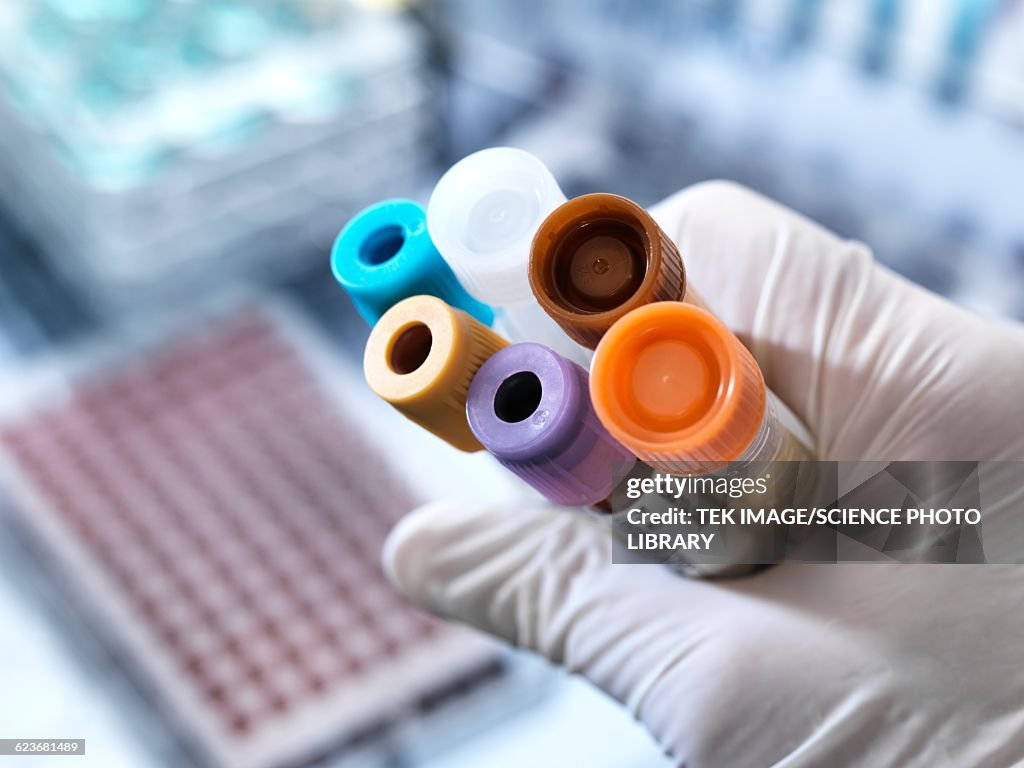 Blood And Other Samples For Testing High-Res Vector Graphic - Getty Images