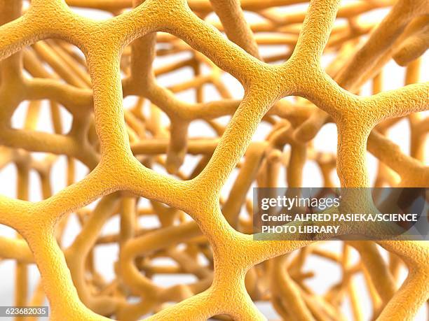 stockillustraties, clipart, cartoons en iconen met osteoporotic bone, artwork - osteoporose