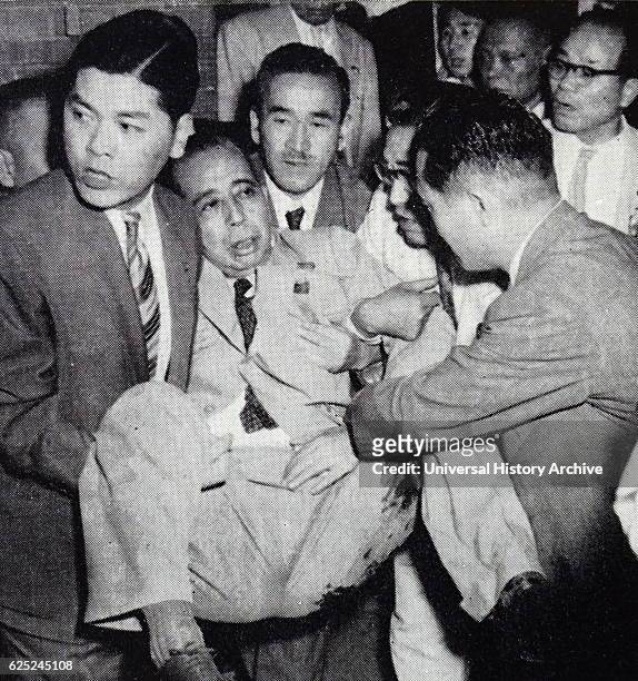 Photograph of Prime Minister Nobusuke Kishi of Japan after being stabbed. Dated 20th Century.