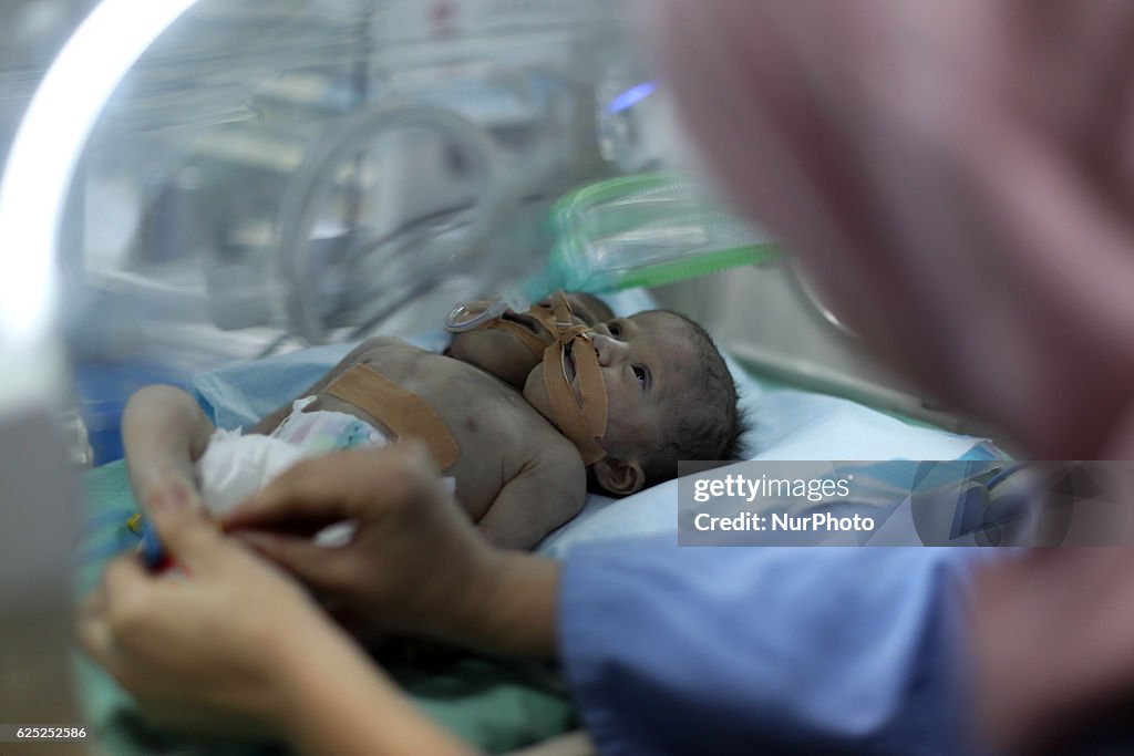 Palestine Twins Medicine