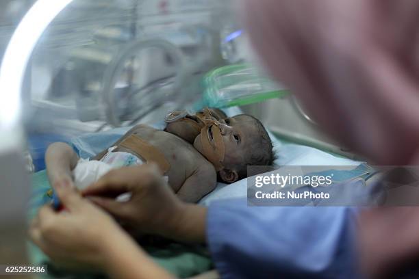 Palestine Twins Medicine, News Photo