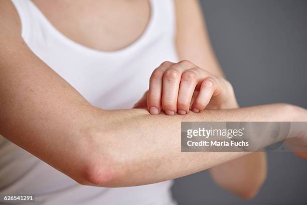 cropped shot of young woman scratching her forearm with fingers - menschlicher arm stock-fotos und bilder