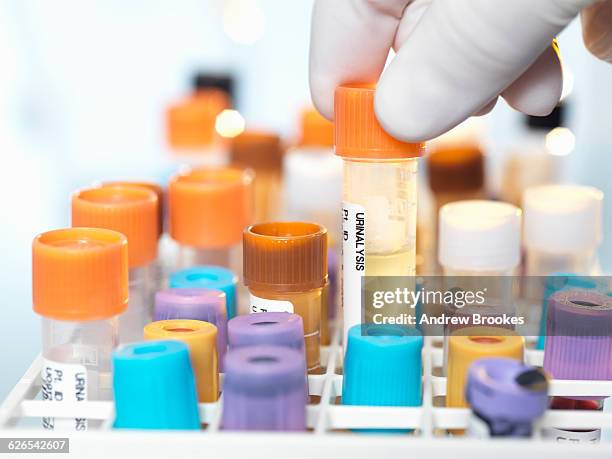 laboratory technician preparing urine sample for medical testing in laboratory - urine sample stock pictures, royalty-free photos & images