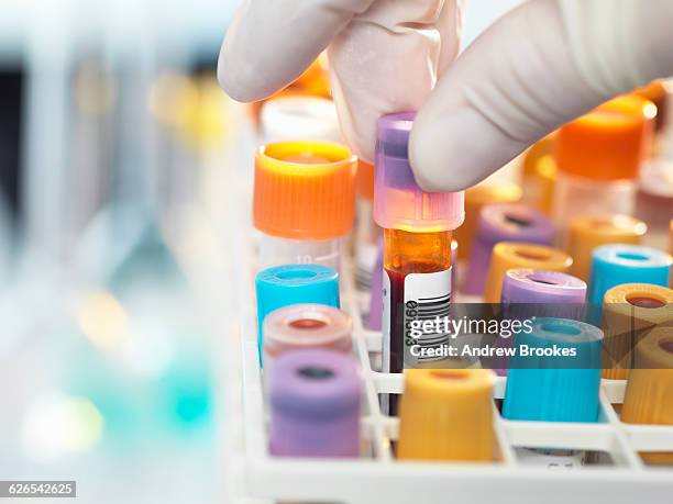 laboratory technician preparing blood sample for medical testing in laboratory - medicinflaska bildbanksfoton och bilder