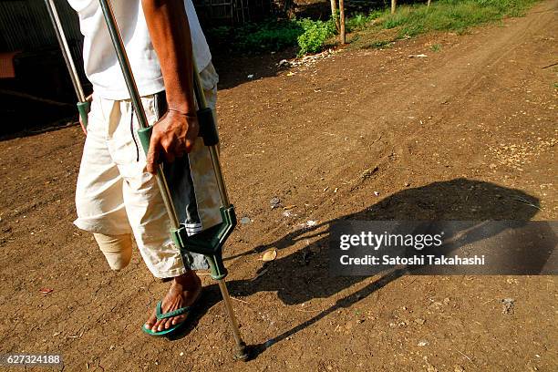 Landmine survivor who lives in Orussey Krom Village at Cambodia-Thai border.