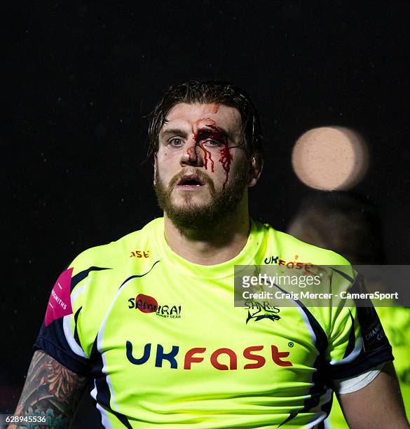 The bloodied face of Laurence Pearce of Sale Sharks during the Rugby Champions Cup Pool 3 match between Saracens and Sale Sharks at Allianz Park on...