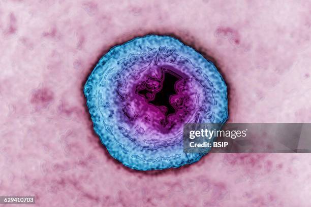 Herpes simplex virus . HSV causes cold sores and genital herpes. Image produced using high-dynamic-range imaging from an image taken with...