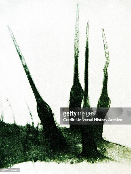 Human hair photographed under a microscope during a 1920's scientific experiment
