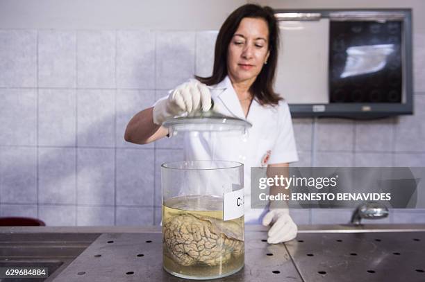 Doctor Diana Rivas opens a jar containing a human brain immersed in formaldehyde at the "Museum of Neuropathology" in Lima on November 16, 2016. The...