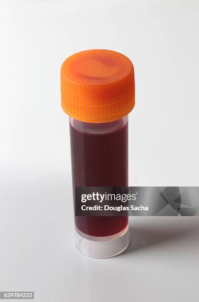 human blood sample in a sterile vial - cholesterol test stock pictures, royalty-free photos & images