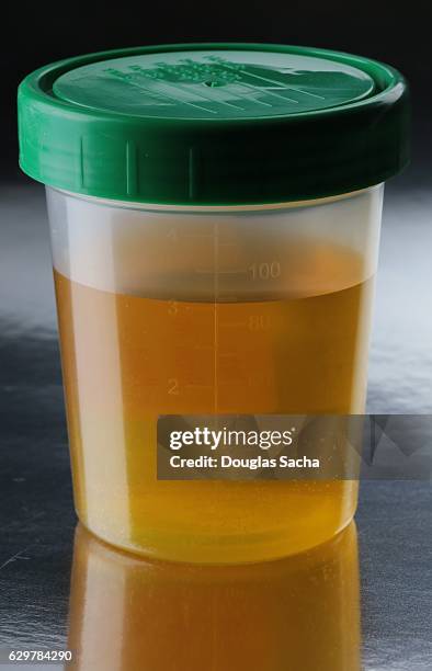 drug testing in a medical laboratory - cholesterol test stock pictures, royalty-free photos & images