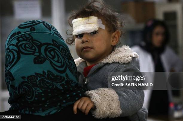 Wounded Iraqi child who was injured during the ongoing fighting between Iraqi forces and jihadists of the Islamic State group in Mosul, receives...