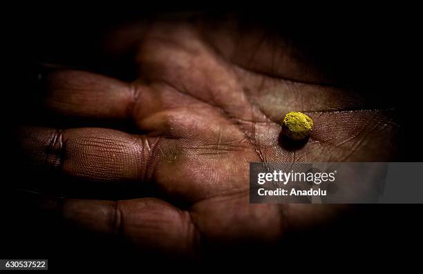 Solid gold is seen in a miners palm in La Rinconada, the highest permanent settlement in the world, in Puno, Peru on November 1, 2016. Miners work...