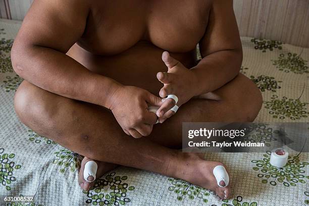 Wrestler tapes his hands as he prepares for practice at a sumo wrestling training camp on the outskirts of Ulaanbaatar, Mongolia on Tuesday, July 26,...