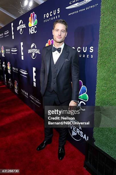 74th ANNUAL GOLDEN GLOBE AWARDS -- Pictured: Actor Justin Hartley poses during the Universal, NBC, Focus Features, E! Entertainment Golden Globes...