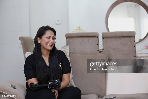 Amputee Zubeyde Nisa Karabacak, 26-years-old, is seen with her "bionic arm" named "Revo" during an exclusive interview at her home in Gaziantep,...