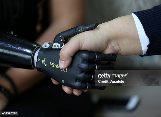 Amputee Zubeyde Nisa Karabacak, 26-years-old, shakes hand with her "bionic arm" named "Revo" during an exclusive interview at her home in Gaziantep,...
