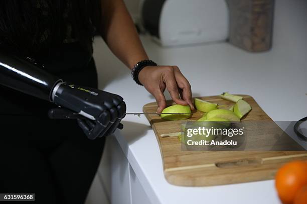 Amputee Zubeyde Nisa Karabacak, 26-years-old, slices an apple with her "bionic arm" named "Revo" during an exclusive interview at her home in...