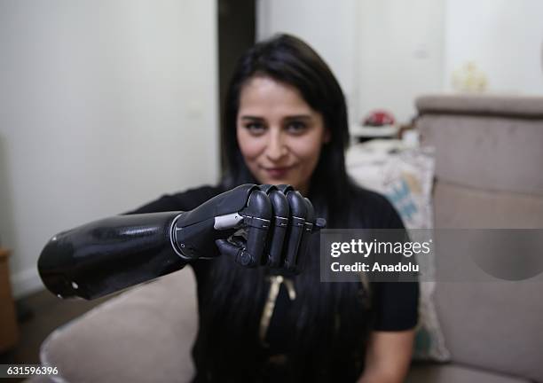 Amputee Zubeyde Nisa Karabacak, 26-years-old, is seen with her "bionic arm" named "Revo" during an exclusive interview at her home in Gaziantep,...