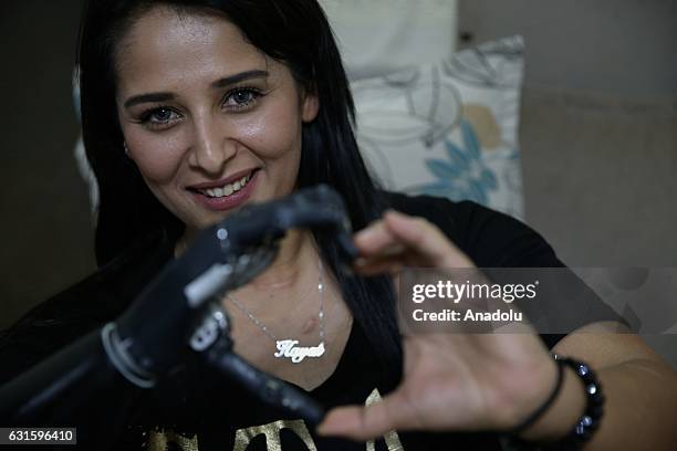 Amputee Zubeyde Nisa Karabacak, 26-years-old, is seen with her "bionic arm" named "Revo" during an exclusive interview at her home in Gaziantep,...