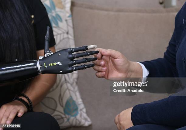 Amputee Zubeyde Nisa Karabacak , 26-years-old, shows her "bionic arm" named "Revo" during an exclusive interview at her home in Gaziantep, Turkey on...