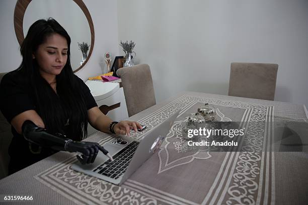 Amputee Zubeyde Nisa Karabacak, 26-years-old, works on a laptop with her "bionic arm" named "Revo" during an exclusive interview at her home in...